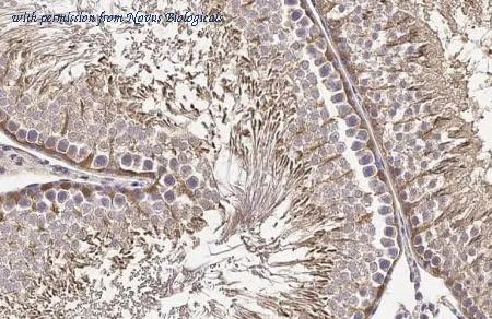 Novus Biologicals NBP3-25558 image 1