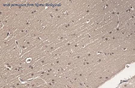 Novus Biologicals NBP3-25371 image 1