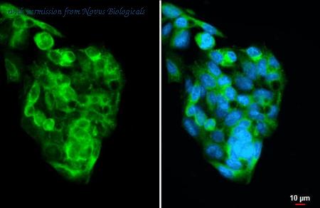 Novus Biologicals NBP3-25613 image 1