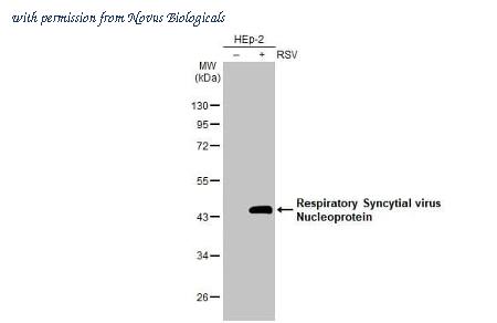 Novus Biologicals NBP3-25630 image 1