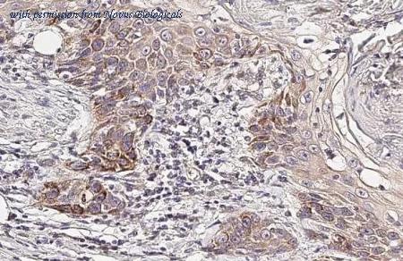 Novus Biologicals NBP3-25427 image 1