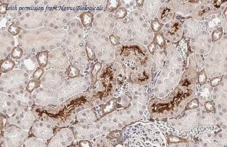 Novus Biologicals NBP3-25417 image 1