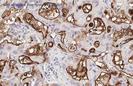 Novus Biologicals NBP3-25620 image 1