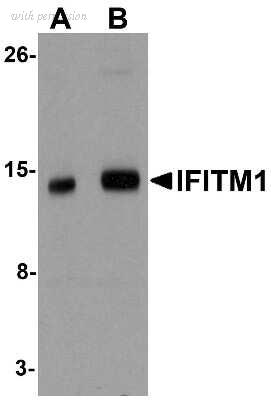 Novus Biologicals NBP1-77171 image 1