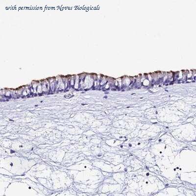 Novus Biologicals NBP1-94078 image 1