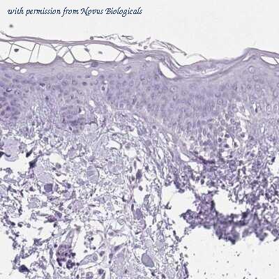 Novus Biologicals NBP2-49277 image 1