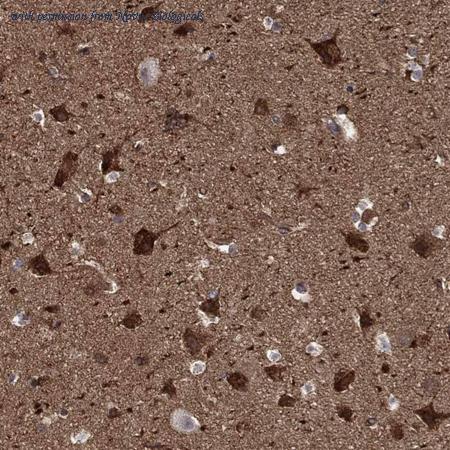 Novus Biologicals NBP3-25063 image 1