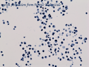 Novus Biologicals NBP3-25995 image 1