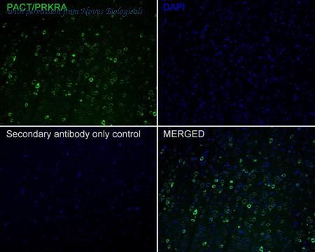 Novus Biologicals NBP3-32705 image 1