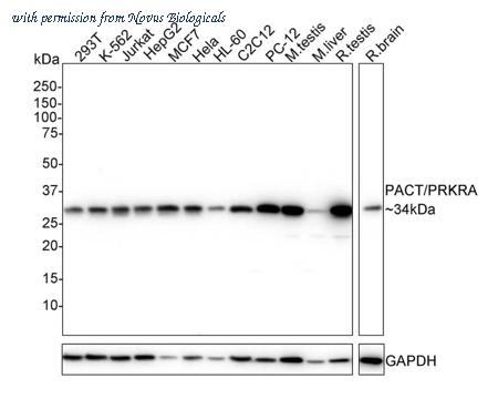 Novus Biologicals NBP3-32706 image 1