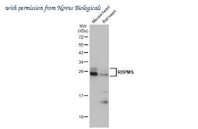 Novus Biologicals NBP3-13722 image 1