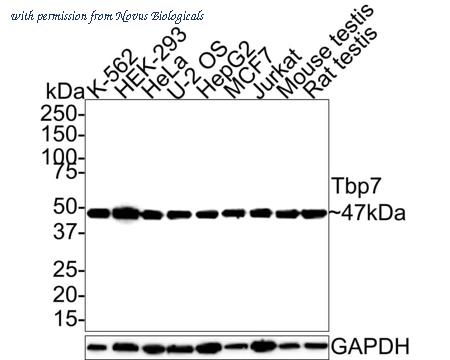 Novus Biologicals NBP3-32997 image 1