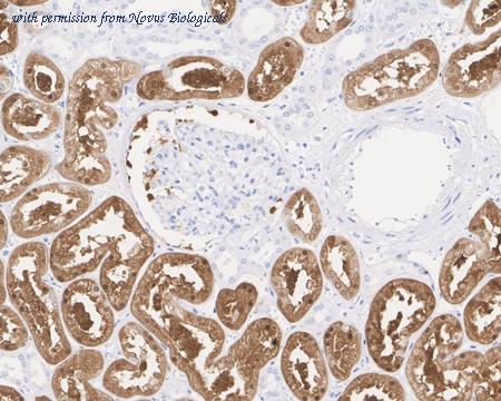 Novus Biologicals NBP3-32496 image 1