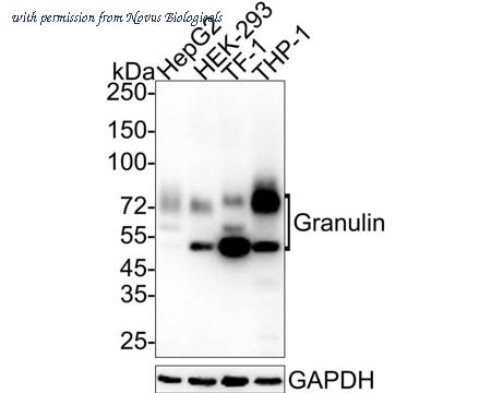 Novus Biologicals NBP3-32371 image 1