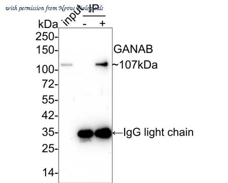 Novus Biologicals NBP3-32366 image 1