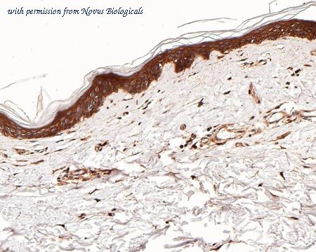 Novus Biologicals NBP3-32255 image 1