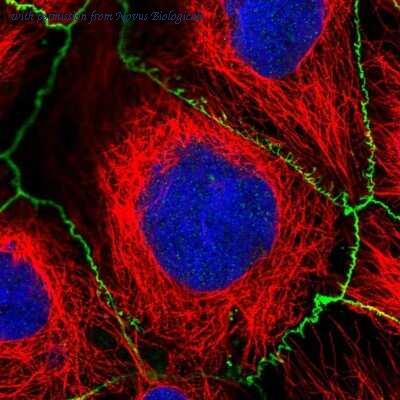 Novus Biologicals NBP2-49440 image 1