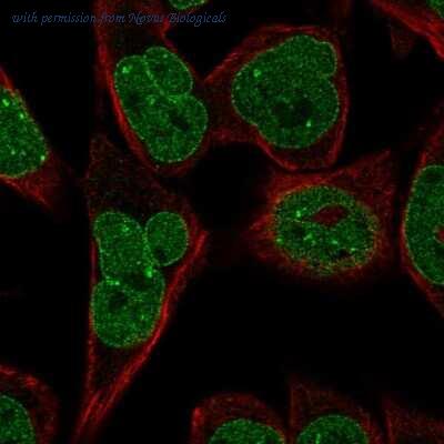 Novus Biologicals NBP2-14163 image 1