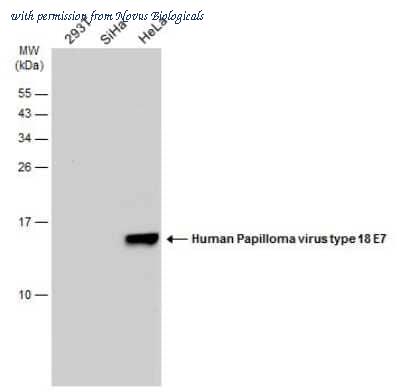 Novus Biologicals NBP3-13610 image 1
