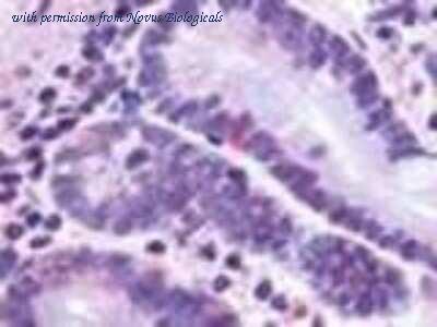 Novus Biologicals NLS1312 image 1