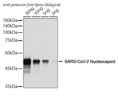 Novus Biologicals NBP3-05730 image 1