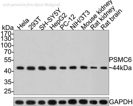 Novus Biologicals NBP3-32866 image 1