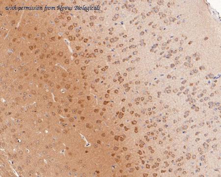 Novus Biologicals NBP3-32872 image 1