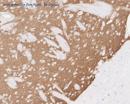 Novus Biologicals NBP3-32729 image 1