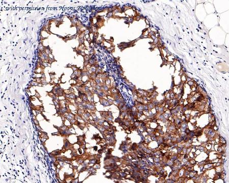 Novus Biologicals NBP3-32422 image 1