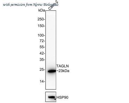 Novus Biologicals NBP3-32992 image 1