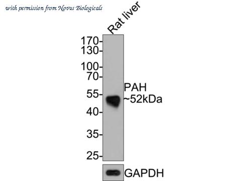 Novus Biologicals NBP3-32708 image 1
