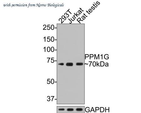 Novus Biologicals NBP3-32844 image 1