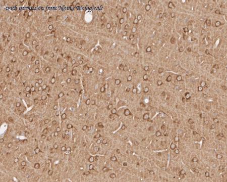 Novus Biologicals NBP3-32474 image 1