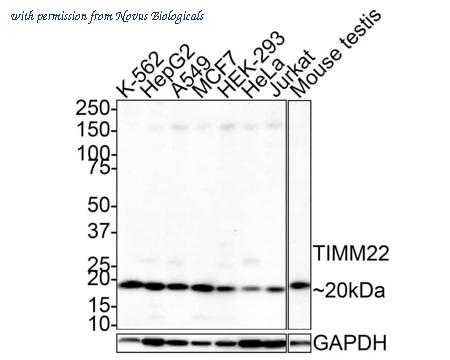 Novus Biologicals NBP3-33021 image 1