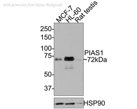 Novus Biologicals NBP3-32820 image 1