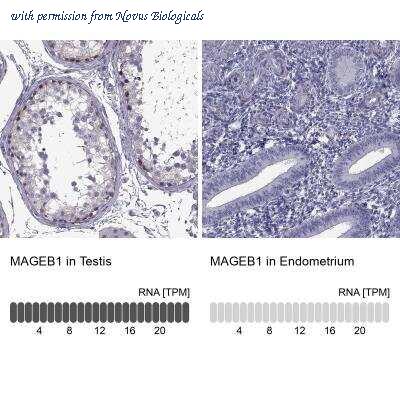 Novus Biologicals NBP1-85405 image 1