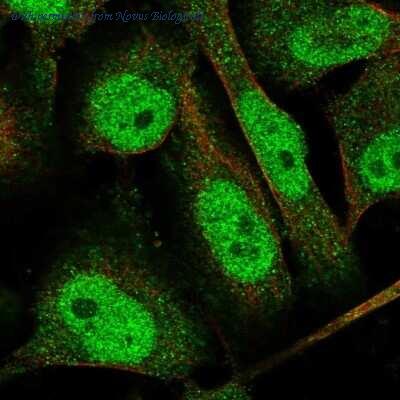 Novus Biologicals NBP1-93640 image 1