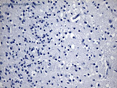 OriGene CF811665 image 1