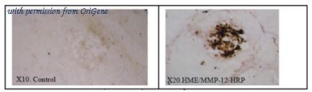 OriGene DDX0280-HRPO-100 image 1
