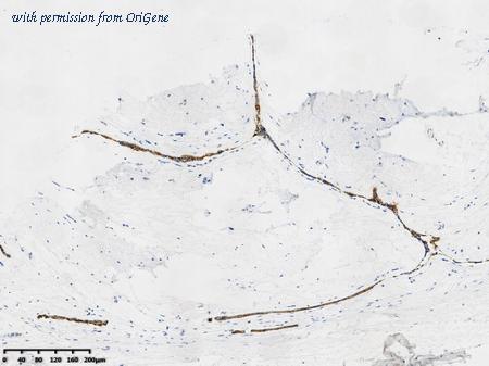 OriGene TA592137 image 1
