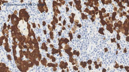 OriGene TA355215 image 1