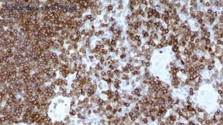 OriGene TA355241 image 1