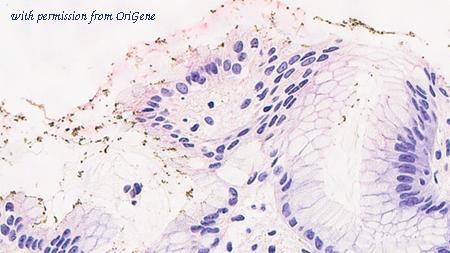 OriGene TA355304 image 1