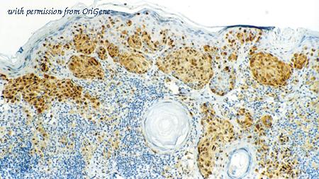 OriGene TA355315 image 1