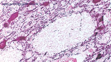 OriGene TA355355 image 1