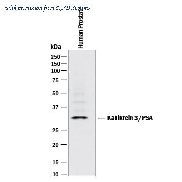 R&D Systems MAB1344-100 image 1