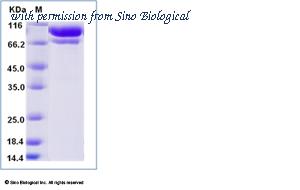 Sino Biological 10154-H08H image 1