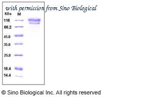 Sino Biological 10103-H02H image 1