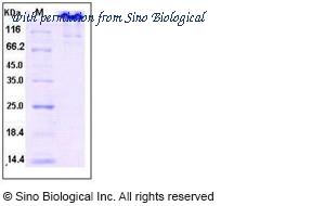 Sino Biological 10174-H02H image 1
