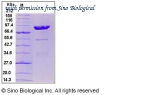 Sino Biological 10069-H02H image 1